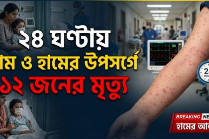 দেশে ২৪ ঘণ্টায় হাম ও হামের উপসর্গে ১২ জনের মৃত্যু