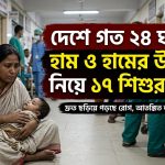 ২৪ ঘণ্টায় হাম ও হামের উপসর্গ নিয়ে ১৭ শিশুর মৃত্যু