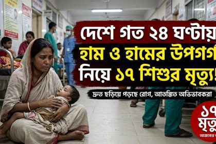 ২৪ ঘণ্টায় হাম ও হামের উপসর্গ নিয়ে ১৭ শিশুর মৃত্যু