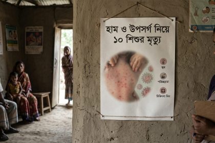 দেশে গত ২৪ ঘণ্টায় হাম ও উপসর্গ নিয়ে ১০ শিশুর মৃত্যু