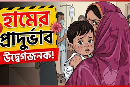 হামের প্রাদুর্ভাব এখনও উদ্বেগজনকভাবে অব্যাহত রয়েছে