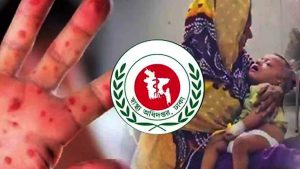 হাম উপসর্গে আরও ৭ শিশুর মৃত্যু