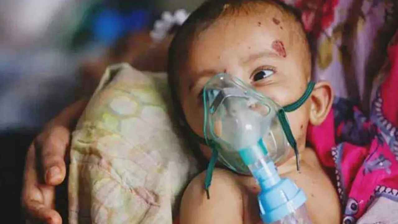 দেশে ২৪ ঘন্টায় হাম উপসর্গে ৬ শিশুর মৃত্যু