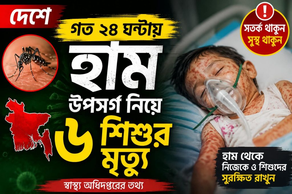 দেশে গত ২৪ ঘণ্টায় হাম উপসর্গ নিয়ে ৬ শিশুর মৃত্যু