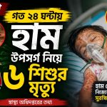 দেশে গত ২৪ ঘণ্টায় হাম উপসর্গ নিয়ে ৬ শিশুর মৃত্যু