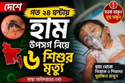 দেশে গত ২৪ ঘণ্টায় হাম উপসর্গ নিয়ে ৬ শিশুর মৃত্যু