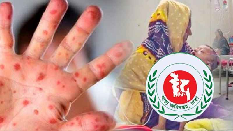 হামের উপসর্গে ১১ জন শিশুর মৃত্যু