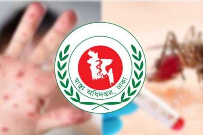 হামের উপসর্গে ও ডেঙ্গু জ্বরে প্রাণ হারিয়েছে ৯জন