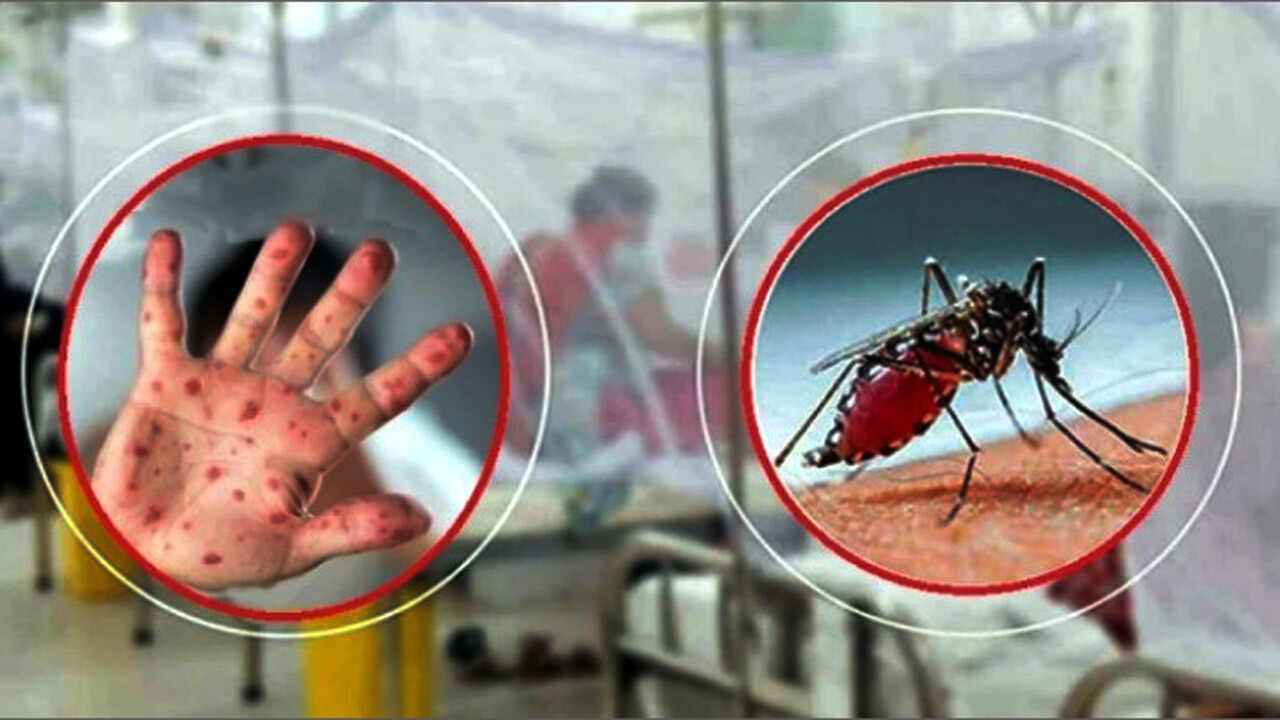 ডেঙ্গু জ্বরে ৭ ও হামের উপসর্গে ১ জন মারা গেছে